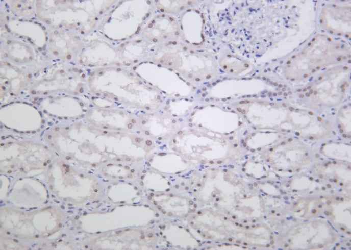 Anti-Human/Mouse/Rat ALKBH5 Antibody [B1018]