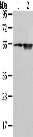Anti-Human SLC1A1 Antibody - ABMIUM