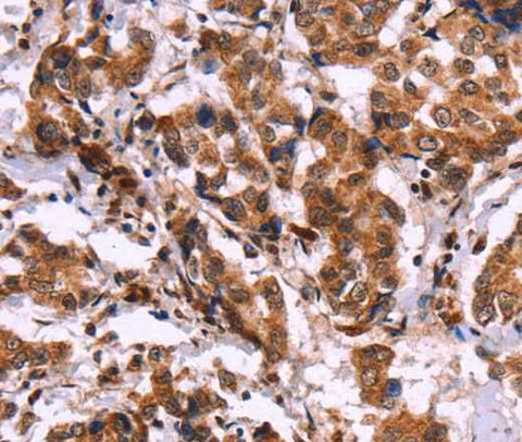 Anti-Human/Mouse CARD11 Antibody