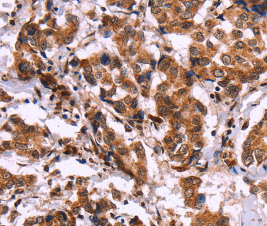 Anti-Human/Mouse CARD11 Antibody - ABMIUM