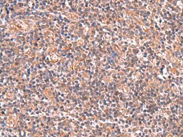 Anti-Human/Mouse/Rat UBAC1 Antibody