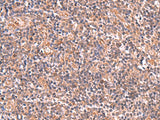 Immunohistochemistry of paraffin-embedded Human tonsil tissue using UBAC1 Polyclonal Antibody at dilution of 1:50(×200)