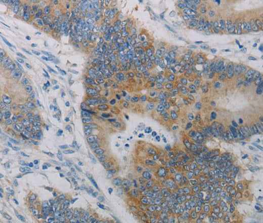 Anti-Human CLEC4C Antibody