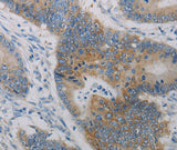 Anti-Human CLEC4C Antibody - ABMIUM