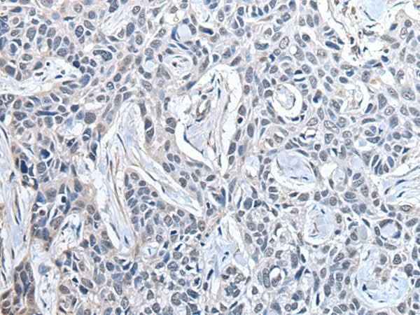 Anti-Human/Mouse/Rat PPIG Antibody