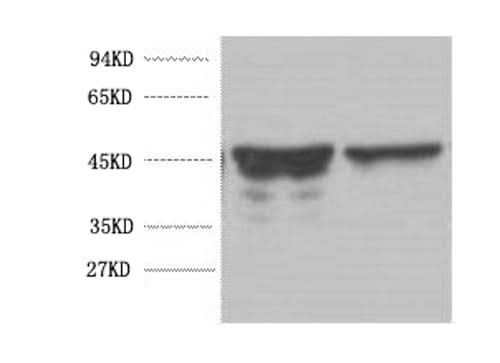 Western Blot analysis of Rat brain using GFAP Monoclonal Antibody at dilution of 1:5000.