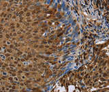 Anti-Human/Mouse/Rat NRP2 Antibody - ABMIUM