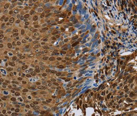Anti-Human/Mouse/Rat NRP2 Antibody