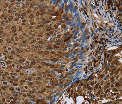Anti-Human/Mouse/Rat NRP2 Antibody