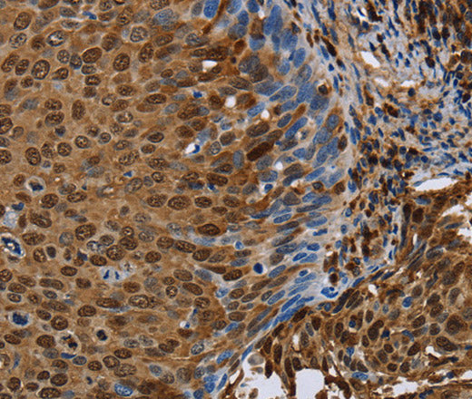 Anti-Human/Mouse/Rat NRP2 Antibody - ABMIUM