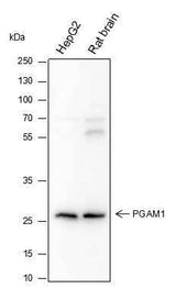 Anti-Human/Rat PGAM1 Antibody [A329]