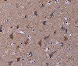 Anti-Human/Mouse TUBGCP2 Antibody - ABMIUM