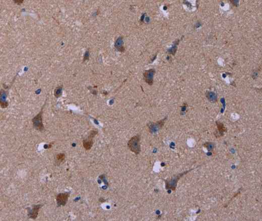 Anti-Human/Mouse TUBGCP2 Antibody