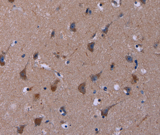 Anti-Human/Mouse TUBGCP2 Antibody - ABMIUM