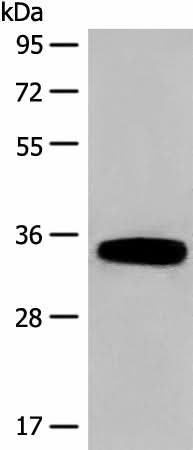Western blot analysis of Human fetal liver tissue lysate using DHRS1 Polyclonal Antibody at dilution of 1:400