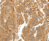 Anti-Human/Mouse/Rat SCT Antibody - ABMIUM