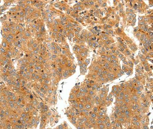 Anti-Human/Mouse/Rat SCT Antibody