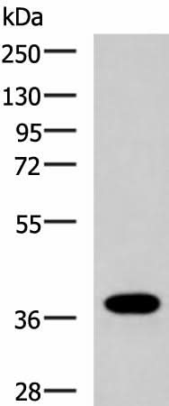 Western blot analysis of Human placenta tissue lysate using GPR6 Polyclonal Antibody at dilution of 1:1000