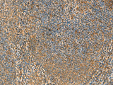 Immunohistochemistry of paraffin-embedded Human tonsil tissue using PPP1R1A Polyclonal Antibody at dilution of 1:50(×200)