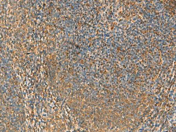 Anti-Human/Rat PPP1R1A Antibody