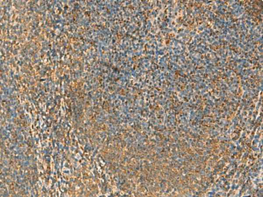Anti-Human/Rat PPP1R1A Antibody