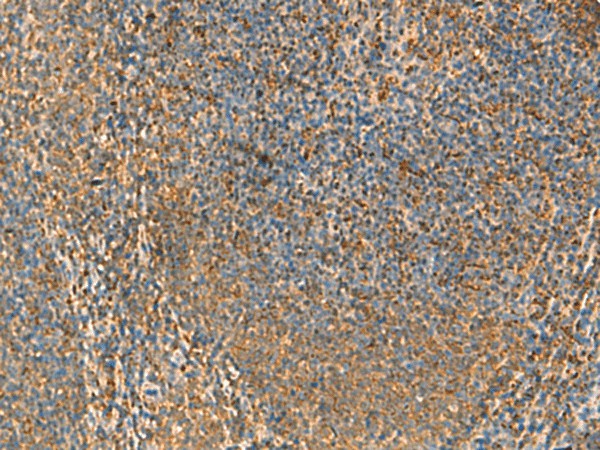 Immunohistochemistry of paraffin-embedded Human tonsil tissue using PPP1R1A Polyclonal Antibody at dilution of 1:50(×200)