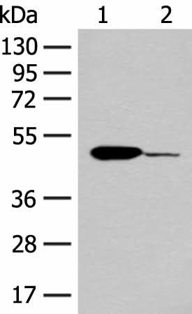 Western blot analysis of Mouse heart tissue and K562 cell lysates using ACOD1 Polyclonal Antibody at dilution of 1:400