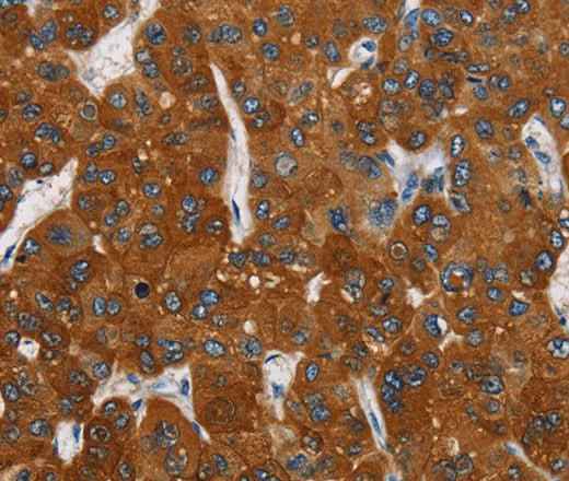 Anti-Human CARD9 Antibody