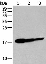 Western blot analysis of Human fetal brain tissue HT-29 cell and Jurkat cell lysates using UBE2V1 Polyclonal Antibody at dilution of 1:250