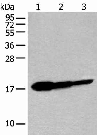 Anti-Human/Mouse UBE2V1 Antibody