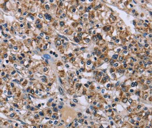 Anti-Human/Mouse/Rat KCNJ11 Antibody
