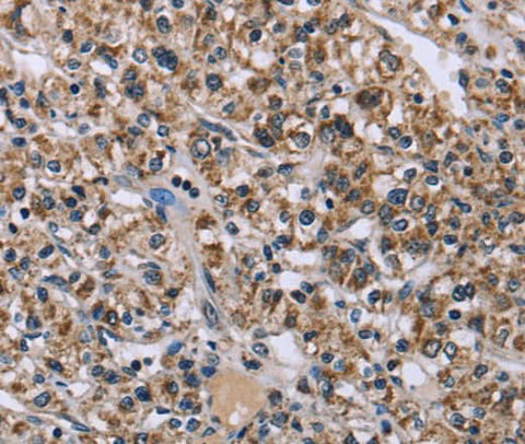 Anti-Human/Mouse/Rat KCNJ11 Antibody - ABMIUM