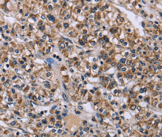 Anti-Human/Mouse/Rat KCNJ11 Antibody - ABMIUM