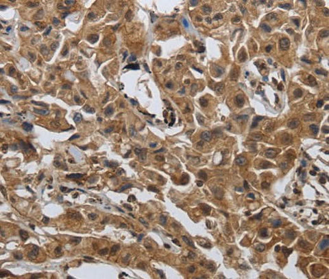 Anti-Human/Mouse PDCD7 Antibody - ABMIUM