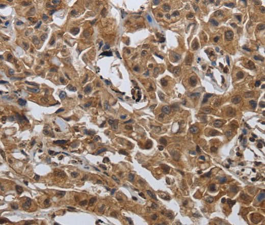 Anti-Human/Mouse PDCD7 Antibody - ABMIUM