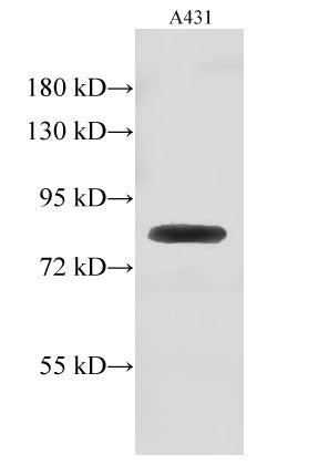Western Blot analysis of A431 cell using GUSB Polyclonal Antibody at dilution of 1:500