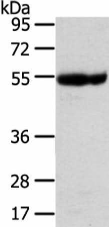 Anti-Human/Mouse/Rat UBAP1 Antibody - ABMIUM
