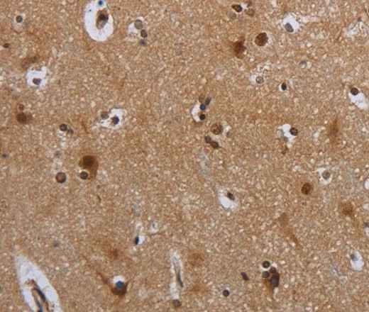 Anti-Human/Mouse MTBP Antibody