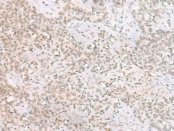 Anti-Human/Mouse/Rat SMNDC1 Antibody