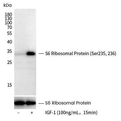 Anti-Human RPS6 Antibody [B295] - ABMIUM