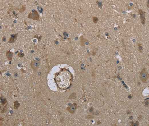 Anti-Human/Mouse MARK4 Antibody