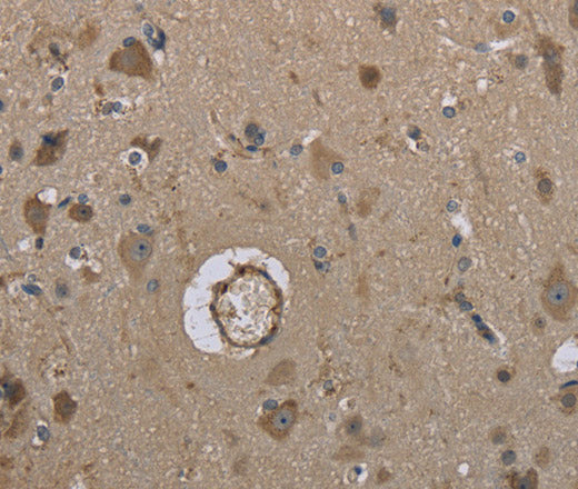 Anti-Human/Mouse MARK4 Antibody - ABMIUM