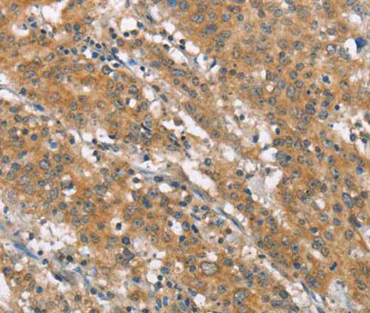 Anti-Human NLRP7 Antibody