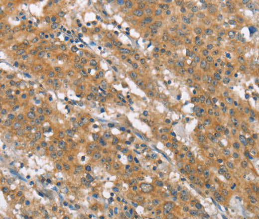 Anti-Human NLRP7 Antibody - ABMIUM