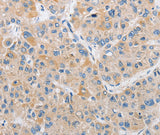 Anti-Human/Mouse/Rat ARHGEF9 Antibody - ABMIUM