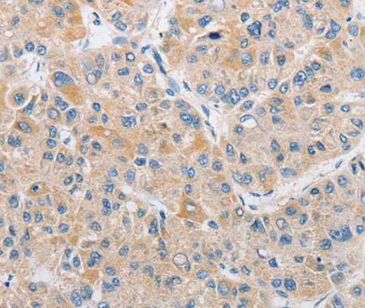 Anti-Human/Mouse/Rat ARHGEF9 Antibody