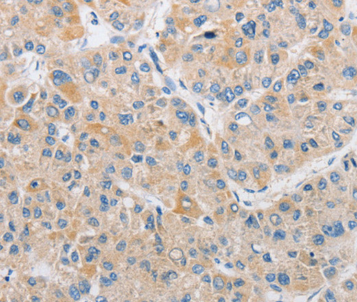 Anti-Human/Mouse/Rat ARHGEF9 Antibody - ABMIUM
