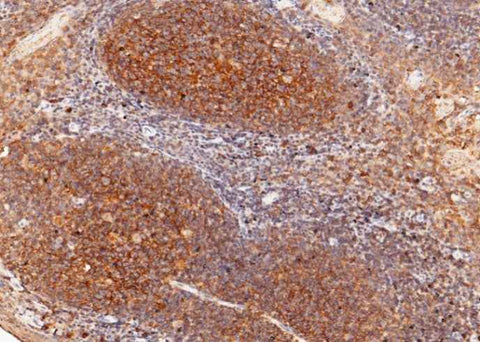 Anti-Human CD82 Antibody [A975] - ABMIUM