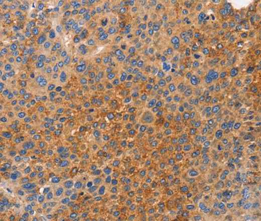 Anti-Human/Mouse NOD1 Antibody