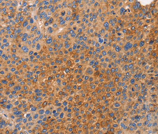 Anti-Human/Mouse NOD1 Antibody - ABMIUM
